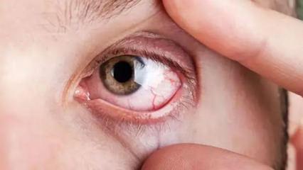 Elinizi bile s&uuml;rmeyin: G&ouml;rme kaybına yol a&ccedil;ıyor! Acilen bunu yapın