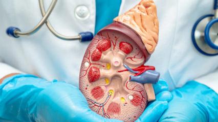 Her 400 kişide bir g&ouml;r&uuml;l&uuml;yor, belirti vermeden ilerliyor! Uzmanlardan b&ouml;brek uyarısı