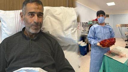 Gaziantep'te 61 yaşındaki adamın 8 kilogramlık b&ouml;breği alındı 