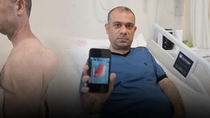 Sırtındaki şişliği &ouml;nemsemedi! Yıllar i&ccedil;inde b&uuml;y&uuml;d&uuml;! Doktorları şoke eden vaka