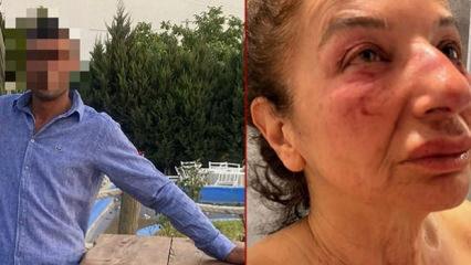 Yalanla ayağına &ccedil;ağırdı &ouml;ld&uuml;resiye d&ouml;vd&uuml;! Saldırgan belediye &ccedil;alışanı &ccedil;ıktı