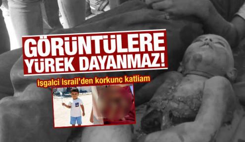 Soykırım 10 ayı devirdi! Küçük Muhammed ikiye bölündü