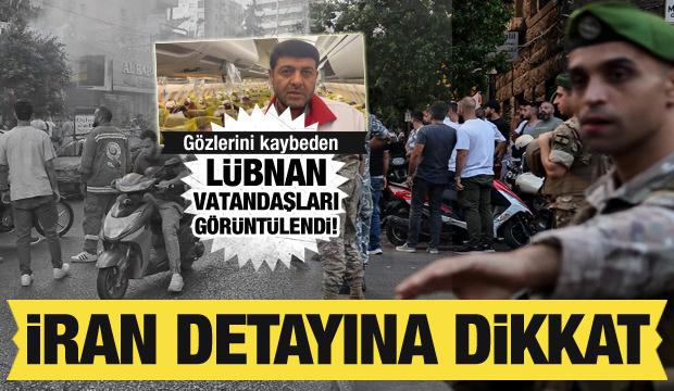 Gözlerini kaybeden Lübnan vatandaşları görüntülendi! İran detayına dikkat