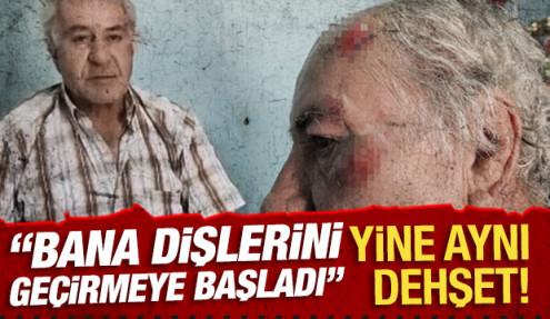 Burdur'da başıboş sokak köpeklerinin saldırdığı kişi yaralandı