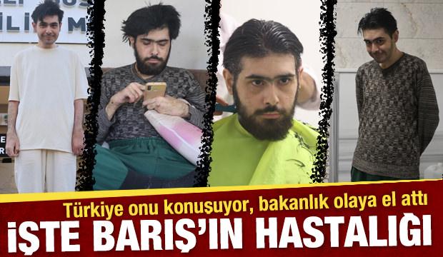 Türkiye onu konuşuyor… Bakanlık olaya el attı: İşte Barış'ın hastalığı