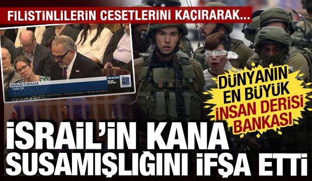 ABD-İslam Konseyi Direktörü ifşa etti: Dünyanın en büyük insan derisi bankası İsrail'de