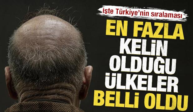 İşte sa&ccedil; d&ouml;k&uuml;lmesinden en muzdarip &uuml;lkeler: T&uuml;rkiye'nin sıralaması belli oldu