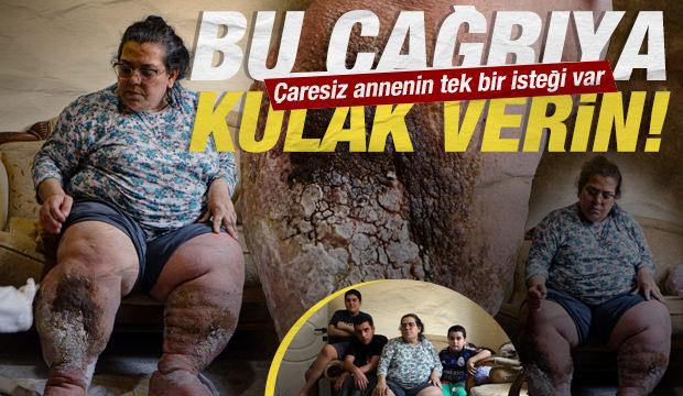 Fil hastası annenin &ccedil;aresiz &ccedil;ığlığı: &Ccedil;ocuklarım i&ccedil;in yaşamak istiyorum