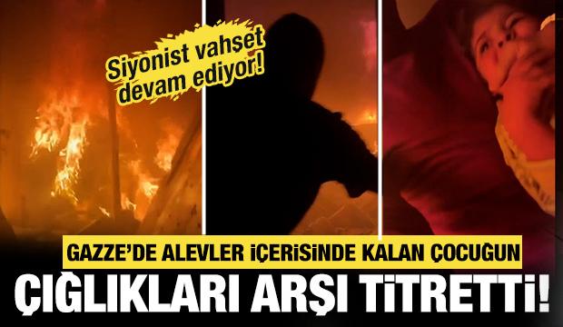 Küçük kız alevler içinde kaldı, yardım çığlıkları arşı titretti!