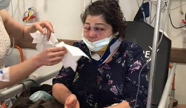 CHP'li Başkanın adamları öldüresiye dövmüştü! Gerekçesi şaşkına çevirdi - Vimarsana News