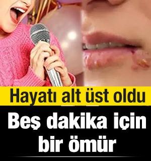 Eğlenirken hijyenden uzaklaştı, herpes virüsüne yakalandı