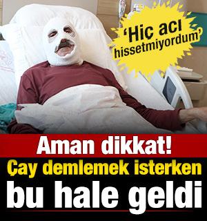 Tüpteki gaz kaçağını kontrol etme yöntemi ölüm getiriyordu! 