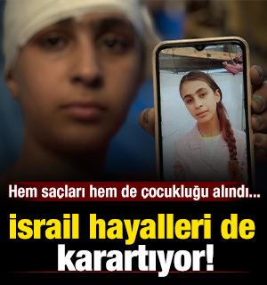 Hem saçları elinden alındı hem de çocukluğu... İsrail hayalleri de karartıyor!