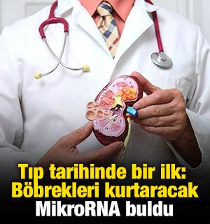 Tıp tarihinde bir ilk: Böbrekleri kurtaracak MikroRNA buldu