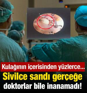 Sivilce sandı gerçeğe doktorlar bile inanamadı!