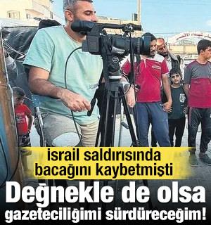 TRT kameramanı Şehade: Değnekle de olsa gazeteciliğimi sürdüreceğim!