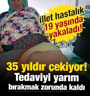Yer: Mersin! 35 yıldır illet hastalıkla mücadele ediyor