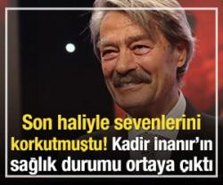 B&ouml;brek yetmezliği yaşıyor denilmişti! Kadir İnanır'ın son durumu ortaya &ccedil;ıktı