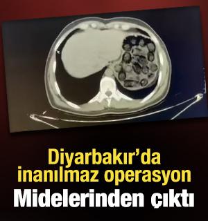 İranlı ş&uuml;phelilerin mide ve bağırsaklarından 91 kaps&uuml;l metamfetamin &ccedil;ıktı