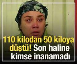 110 kilodan 50 kiloya d&uuml;şt&uuml;! Son haline kimse inanamadı