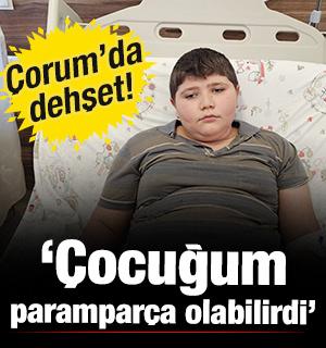 &Ccedil;orum'da k&ouml;pek dehşeti! Muhammet'in annesi konuştu: '&Ccedil;ocuğum parampar&ccedil;a olabilirdi'