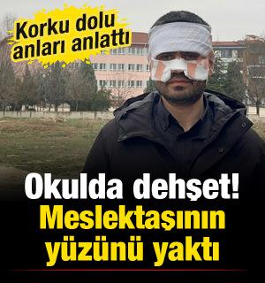 Okulda korku dolu anlar! Eskişehir'de &ouml;ğretmen meslektaşının y&uuml;z&uuml;n&uuml; yaktı iddiası