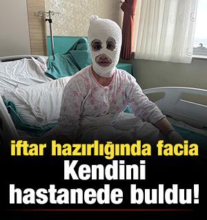 İftar hazırlığında facia: D&uuml;d&uuml;kl&uuml; tencere y&uuml;z&uuml;ne patladı!