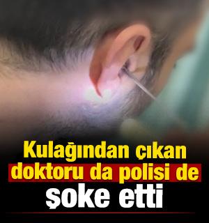 Kayseri'de akılalmaz olay: Kulağına gizlediği uyuşturucuyla yakalandı