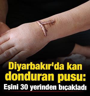 Diyarbakır'da kan donduran olay! Eşini 30 yerinden bı&ccedil;akladı 