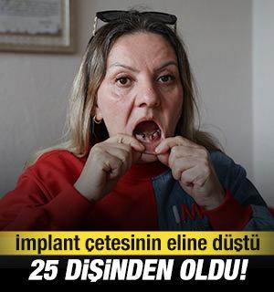 İmplant &ccedil;etesinin eline d&uuml;şen kadın hem 25 dişinden hem de 36 &ccedil;eyrek altınından odu