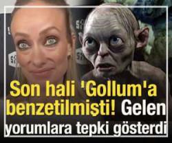  Son hali Gollum'a benzetilmişti! Gelen yorumlara tepki g&ouml;sterdi