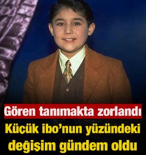 K&uuml;&ccedil;&uuml;k İbo&rsquo;nun y&uuml;z&uuml;ndeki değişim g&uuml;ndem oldu
