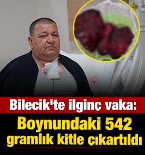 Bilecik'te ilgin&ccedil; vaka: Boynundaki 542 gramlık kitle &ccedil;ıkartıldı 