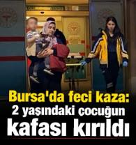 Bursa'da feci kaza: 2 yaşındaki &ccedil;ocuğun kafası kırıldı