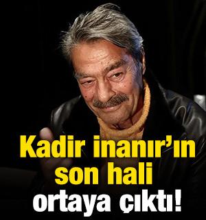Kadir İnanır'ın son hali ortaya &ccedil;ıktı!