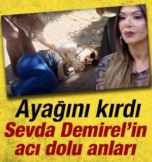 Sevda Demirel&rsquo;in acı dolu anları: Ma&ccedil;ka Parkı&rsquo;nda ayağını kırdı