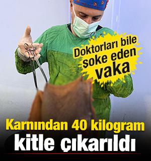 Aydın'da şoke eden operasyon: Karnından 40 kilogram kitle &ccedil;ıkarıldı