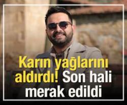Karın yağlarını aldırdı! Son hali merak edildi
