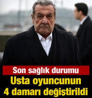 Usta oyuncunun 4 damarı değiştirildi 
