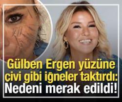 G&uuml;lben Ergen y&uuml;z&uuml;ne &ccedil;ivi gibi iğneler taktırdı: Nedeni merak edildi!