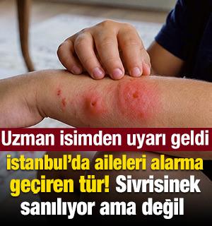 Asya Kaplan Sivrisineği vakaları endişeye yol a&ccedil;tı: Alerjik b&uuml;nyeye sahipseniz dikkat!