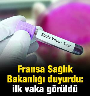 Fransa'da ebola vakası g&ouml;r&uuml;ld&uuml;