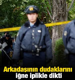 Arkadaşının dudaklarını iğne iplikle dikti!