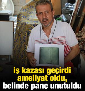 İş kazası ge&ccedil;irdi, ameliyat oldu, belinde pan&ccedil; unutuldu