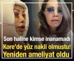 Kore&rsquo;de y&uuml;z nakli olmuştu! Yeniden ameliyat oldu 