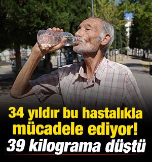 34 yıldır bu hastalıkla m&uuml;cadele ediyor! 39 kilograma d&uuml;şt&uuml; 