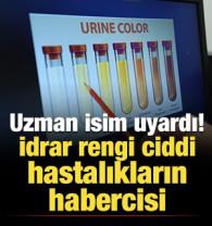 İdrar rengi ciddi hastalıkların habercisi: Uzmanı uyardı!