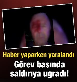 Haber yaparken saldırıya uğrayan muhabir yaralandı