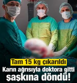 Karın ağrısıyla doktora gitti ger&ccedil;eği g&ouml;r&uuml;nce şaşkına d&ouml;nd&uuml;! Tam 15 kg &ccedil;ıkarıldı...