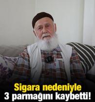 Sigara nedeniyle 3 parmağını kaybetti!